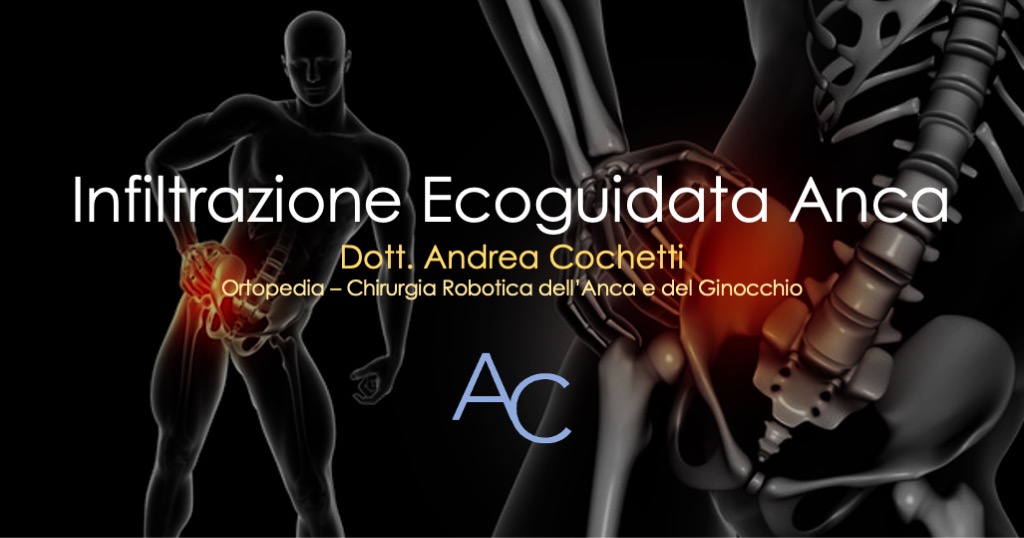 infiltrazione ecoguidata anca
